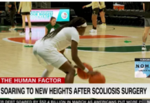 University Of Miami Basketball Player Soars To New Heights After Surgery