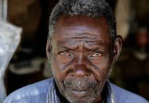 Disparities In Diagnosis, Treatment For African Americans With Alzheimer’s