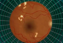 As AI Eye Exams Prove Their Worth, Lessons For Future Tech Emerge