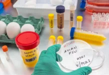 Bird Flu Is Bad For Poultry And Dairy Cows. It’s Not A Dire Threat For Most Of Us — Yet.