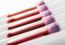 Thousands Of Children Got Tested For Lead With Faulty Devices: What Parents Should Know