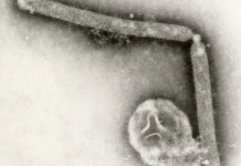 Strain Of Bird Flu Virus Never Before Reported In People Is Behind First Human Case In U.S. In Nine Months