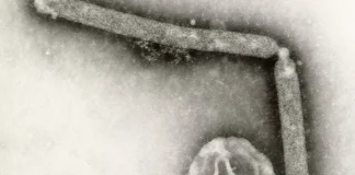 Strain Of Bird Flu Virus Never Before Reported In People Is Behind First Human Case In U.S. In Nine Months