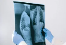 Don’t Roll Back Game-Changing Testing for Cancer Patients