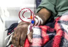 Ending Race-based Test Helps Black Kidney Patients