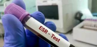 Study Examines Whether Dropping ESR Tests Actually Lowers Costs