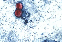 What To Know About Cyclospora, The Gut-Churning Parasite Causing Illness In Several States, And How To Avoid It