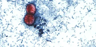 What To Know About Cyclospora, The Gut-Churning Parasite Causing Illness In Several States, And How To Avoid It