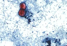 First Deaths Reported In Cyclosporiasis Outbreak