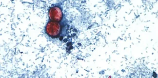 First Deaths Reported In Cyclosporiasis Outbreak