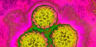 About 1 In 8 Cancer Cases Worldwide Are Tied To These Infections — Most Of Them Preventable